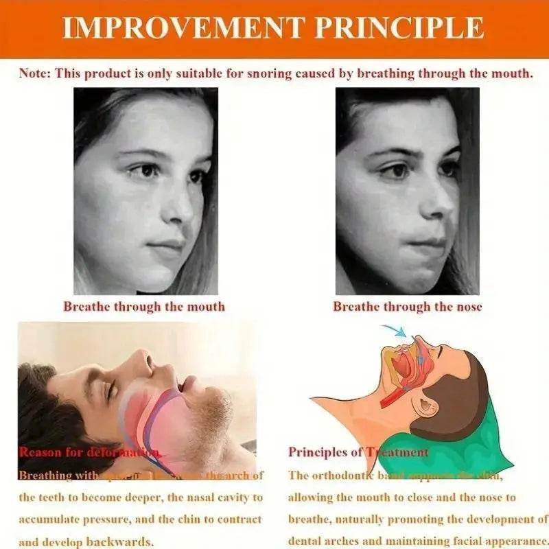 Anti-snoring Band Open Mouth Breathing Corrective Anti-snoring Chin Rest - Dabfavshop
