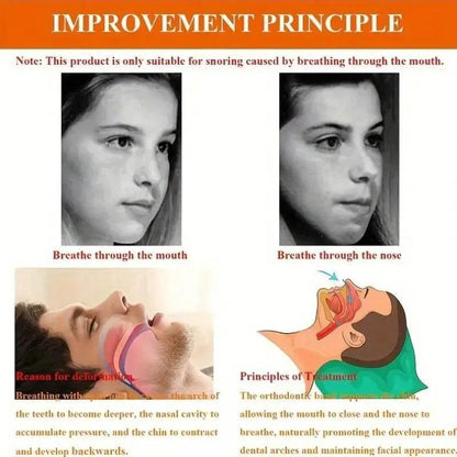 Anti-snoring Band Open Mouth Breathing Corrective Anti-snoring Chin Rest - Dabfavshop